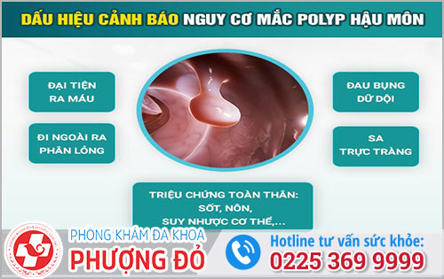 Triệu chứng Polyp hậu môn