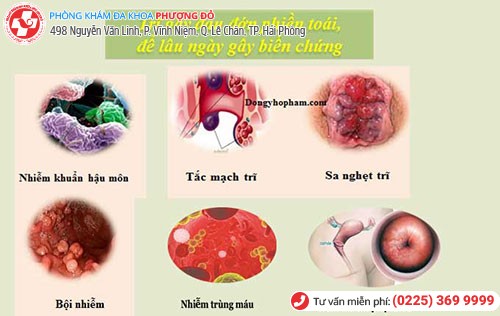 Những biến chứng bệnh trĩ ở mức độ nặng