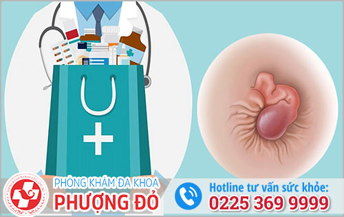 Các Loại Thuốc Chữa Trĩ Hiện Nay