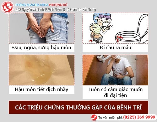 Cách chữa bệnh trĩ sau sinh an toàn, tiết kiệm 