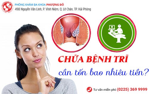 chi phí chữa trĩ