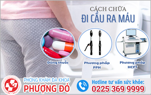 Điều trị đi cầu ra máu