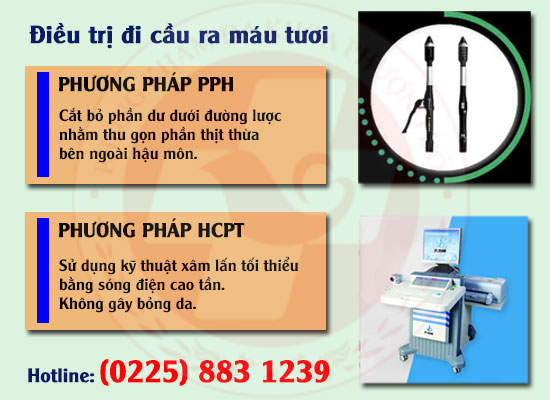 Điều trị đi cầu ra máu tươi