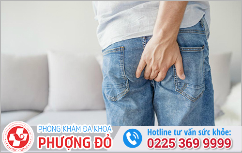Ngứa hậu môn bôi thuốc gì?