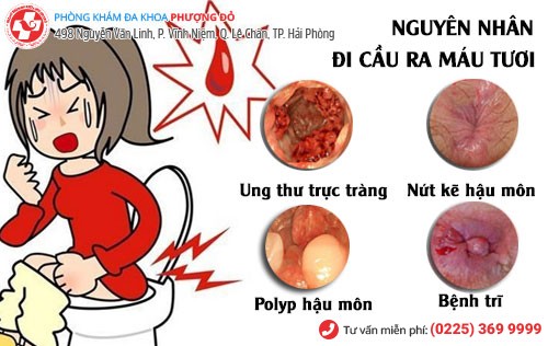 Nguyên nhân đi cầu ra máu tươi