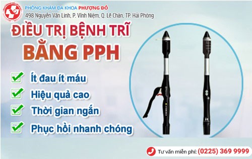 Kỹ thuật PPH