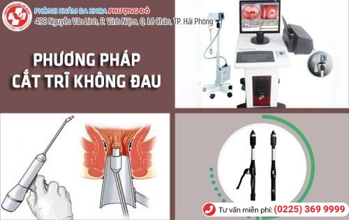 Phương pháp cắt trĩ không đau