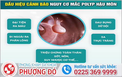 Biểu hiện bệnh polyp hậu môn