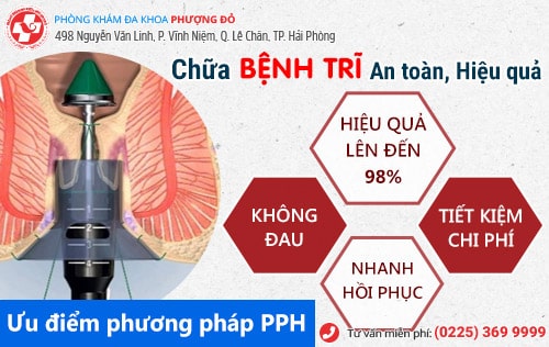 phương pháp điều trị bệnh trĩ