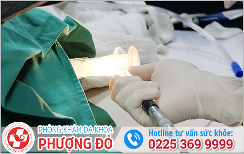 Những Phương Pháp Chữa Trị Hiệu Quả Nhất Hiện Nay