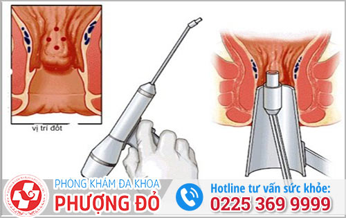 Những Phương Pháp Hỗ Trợ Điều Trị Hiệu Quả Hiện Nay