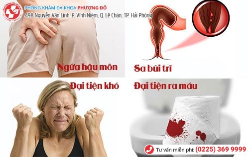 Dấu hiệu bệnh trĩ sau sinh