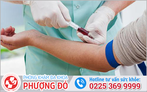 Khi nào nên đi xét nghiệm bệnh lậu mãn tính?