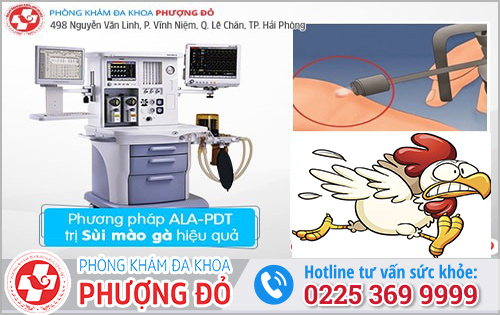 Chữa sùi mào gà bằng ALA – PDT