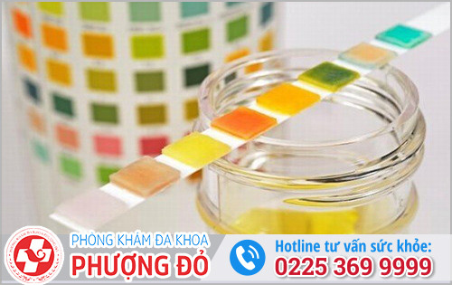 Làm xét nghiệm nước tiểu có phát hiện bệnh lậu không?