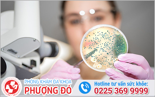 Khi nào nên đi xét nghiệm để kiểm tra bệnh lậu?