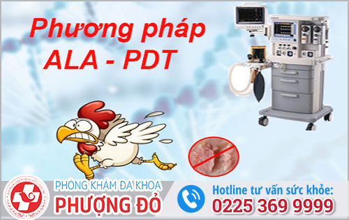 Phương pháp điều trị sùi mào gà chuyên sâu