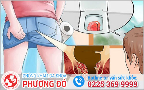 Dấu hiệu bị chảy máu ở hậu môn là bệnh gì? Có cần đi khám không?