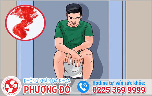 Đi ngoài ra máu là triệu chứng không nên xem nhẹ