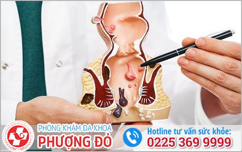 Bệnh Trị Nếu Không Chữa Trị Có Tự Hết Không?