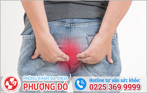 Lòi thịt ở hậu môn- triệu chứng không nên xem nhẹ