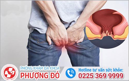 Rách hậu môn - Dấu hiệu cảnh báo một vài vấn đề sức khỏe mà bạn không ngờ tới