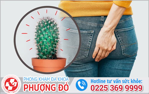 Tìm hiểu bệnh trĩ là gì? Và cách nhận biết