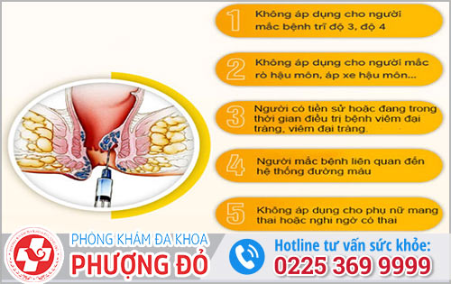 Phương pháp tiêm xơ búi trĩ – có phải là giải pháp tốt?