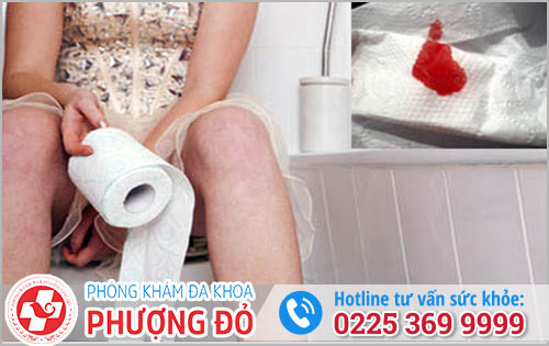 Triệu chứng trĩ ra máu người bệnh cần lưu ý