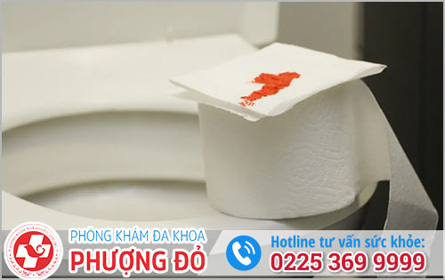 Xuất huyết hậu môn – đừng nghĩ là bệnh đơn giản